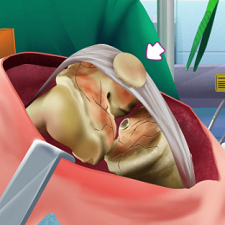 Knee Surgery Simulator